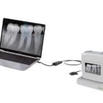 سنسور صيني DXI